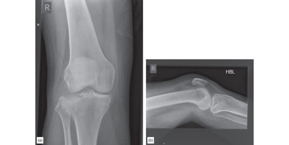Figure 11.1