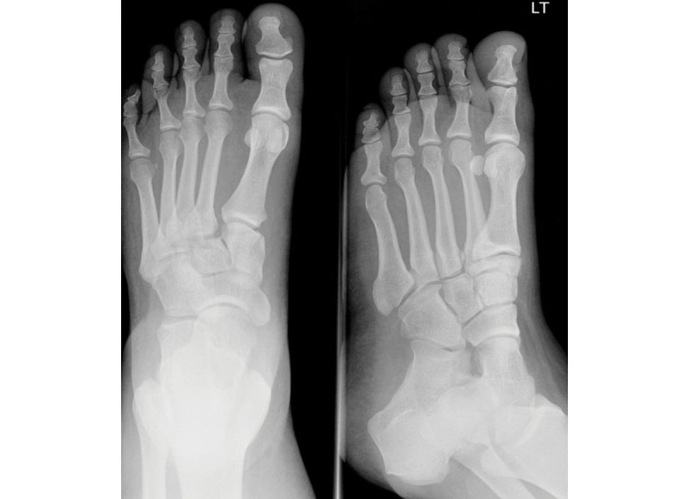 Figure 11.3