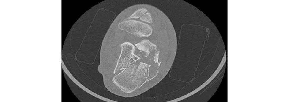 Figure 11.4b
