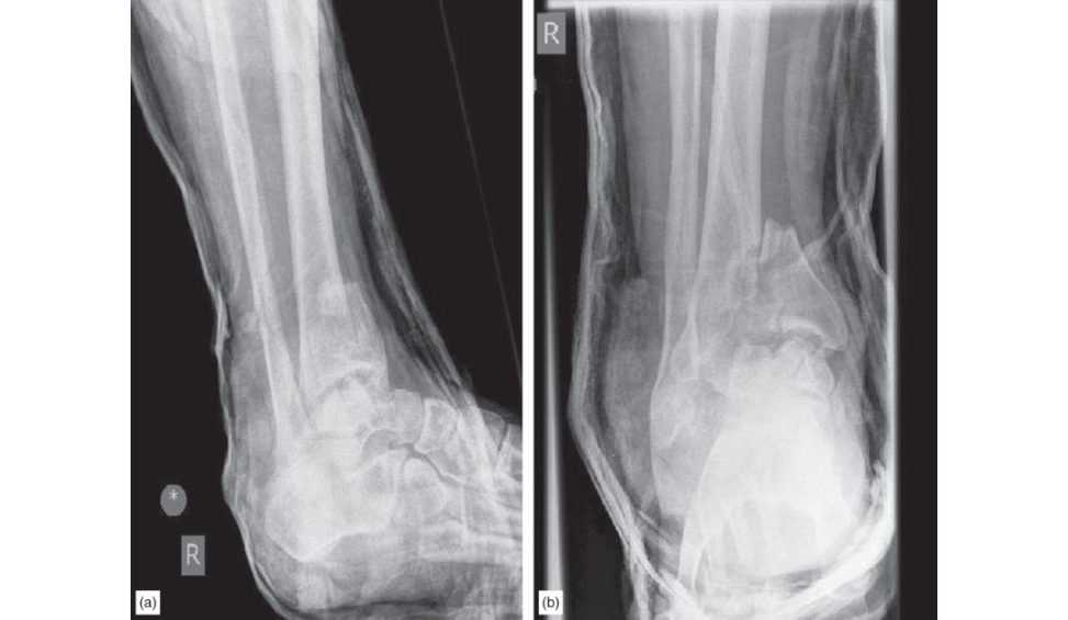 Figure 11.5