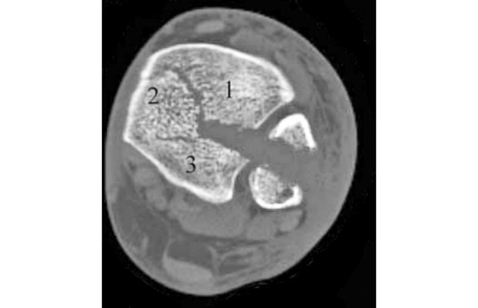 Figure 11.5c