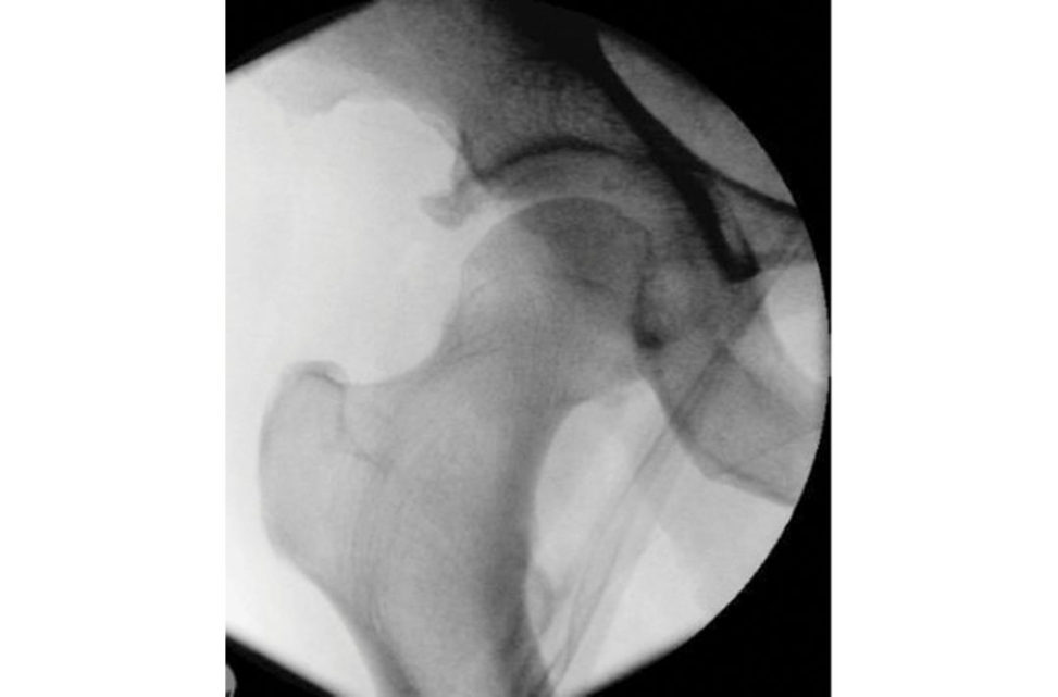 Figure 11.6a
