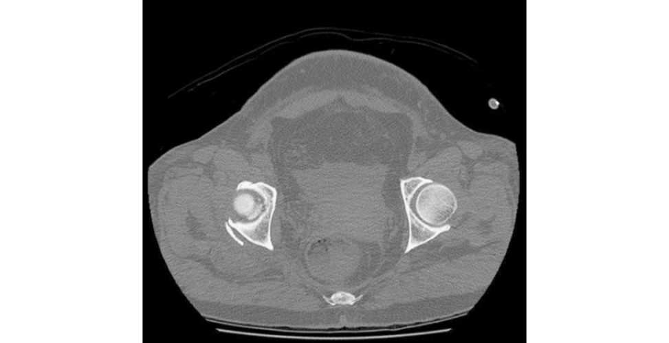 Figure 11.6b