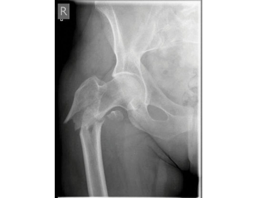 Figure 11.7a