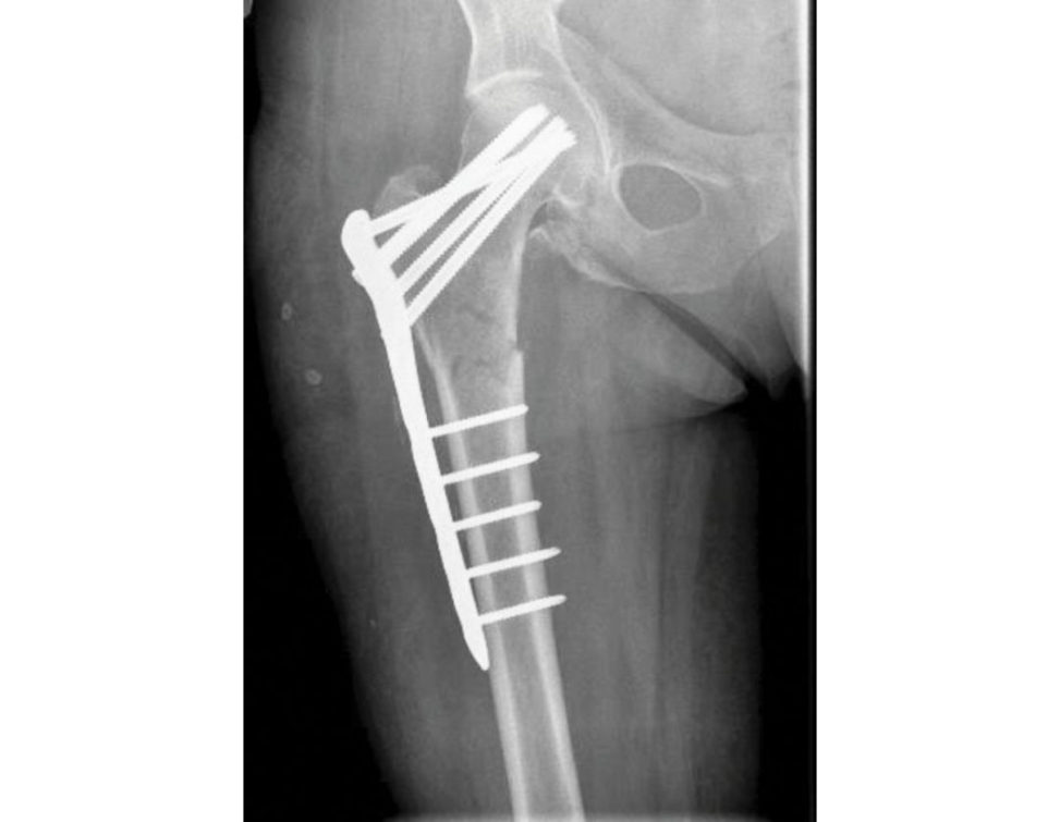 Figure 11.7b