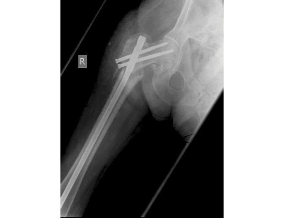 Figure 11.7d