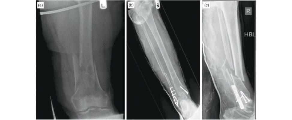 Figure 11.8