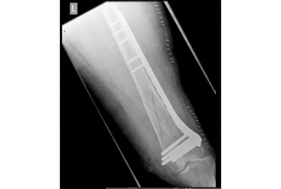 Figure 11.8d