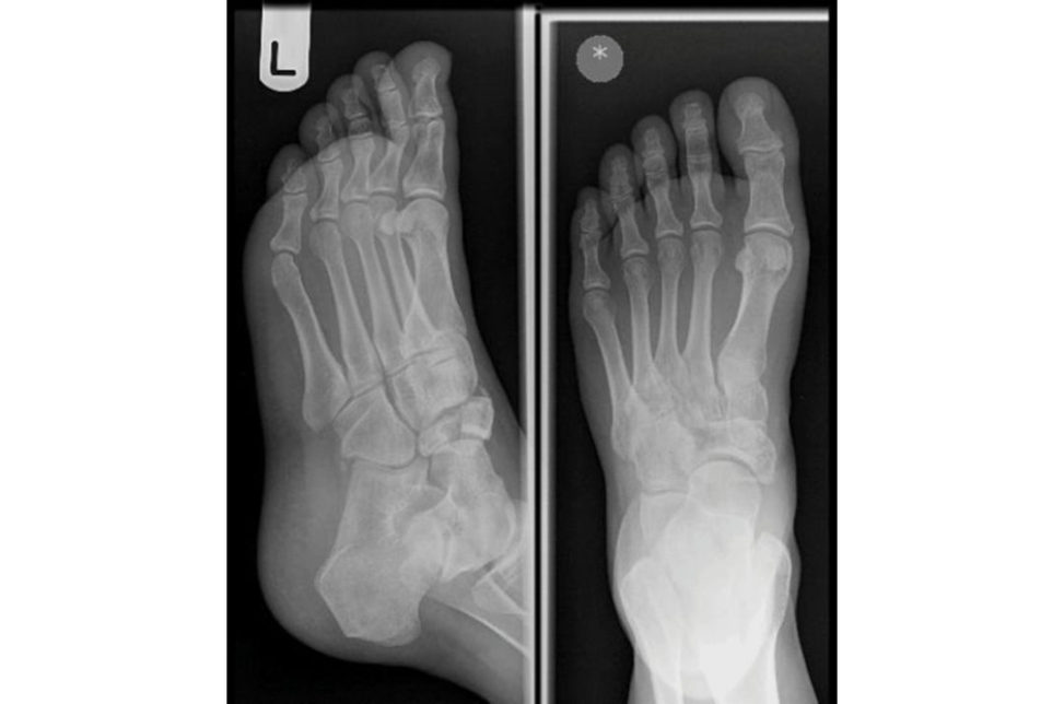 Figure 11.9a