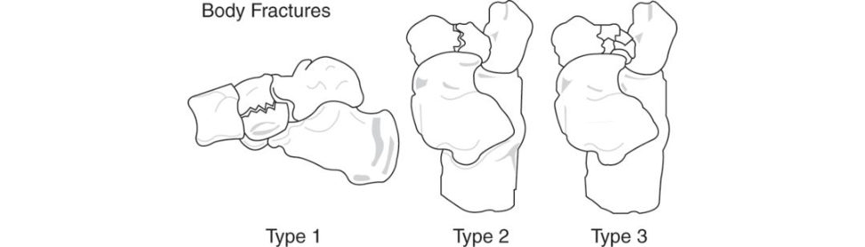 Figure 11.9b