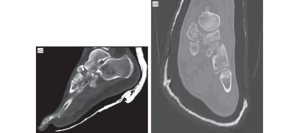 Figure 11.9c