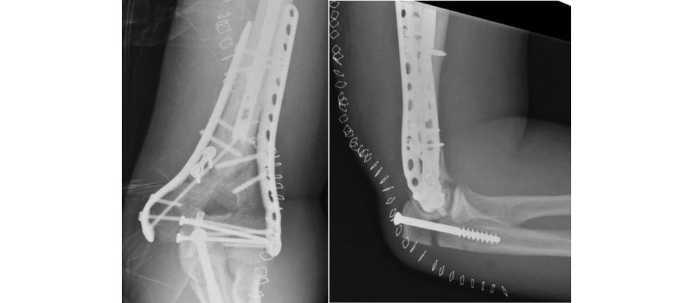 Figure 12.3b