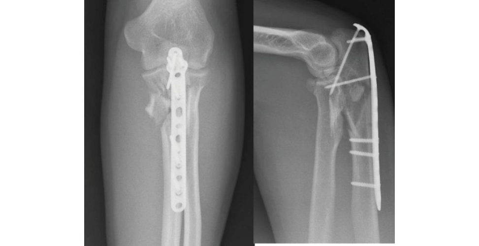 Figure 12.4b
