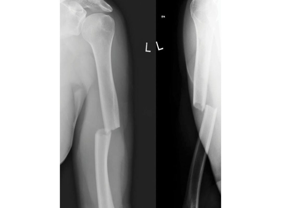 Figure 12.6a
