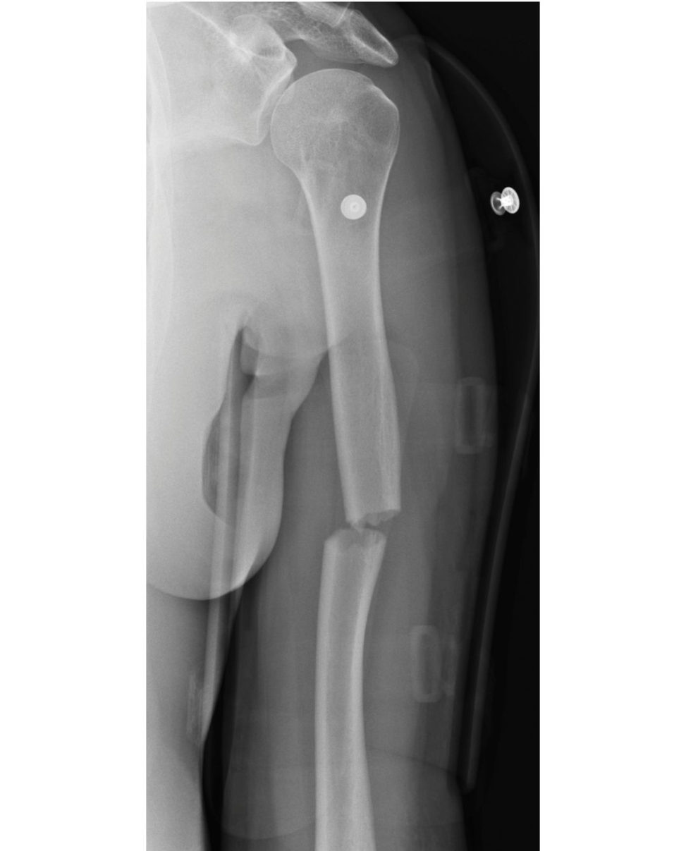 Figure 12.6b