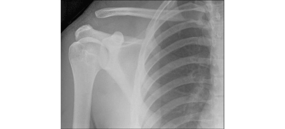 Figure 12.8