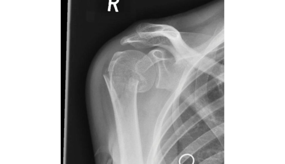 Figure 12.9