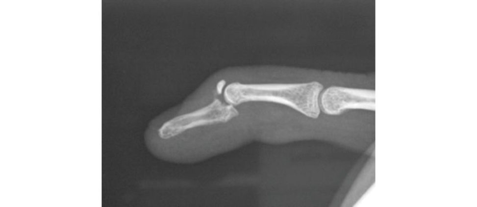 Figure 13.4b