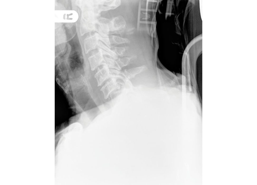 Figure 15.1a