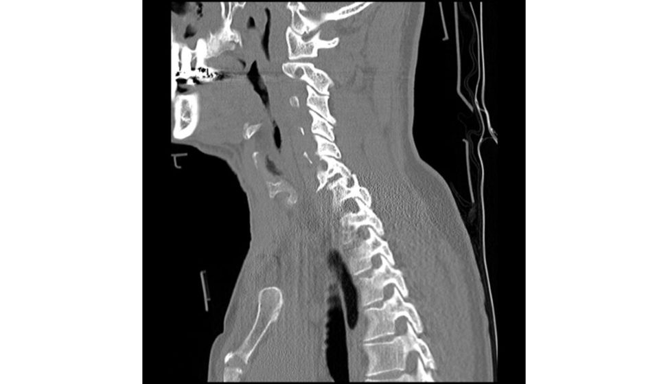 Figure 15.1b