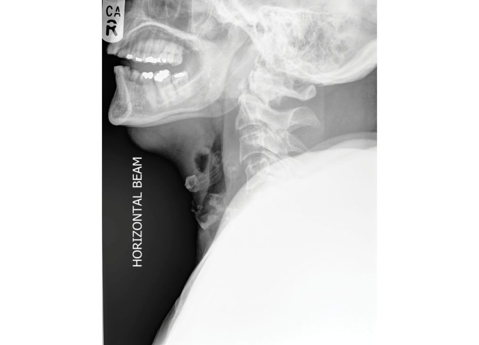 Figure 15.4a