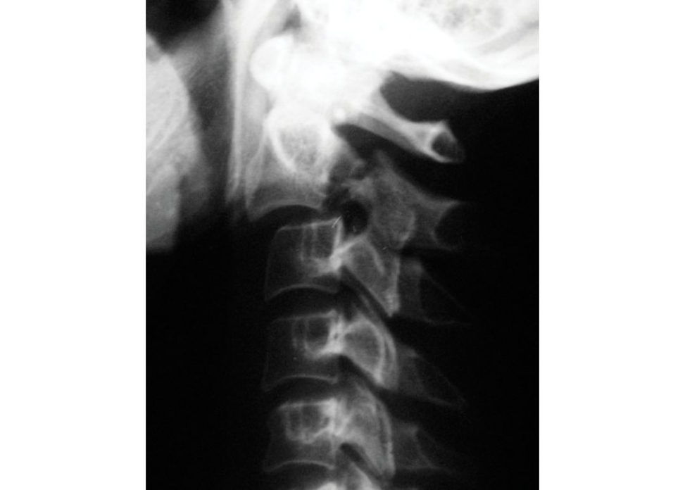 Figure 15.5