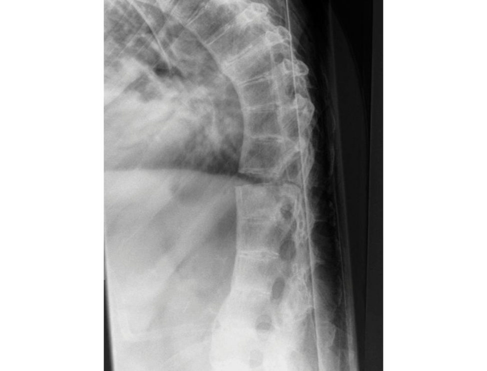 Figure 15.6b