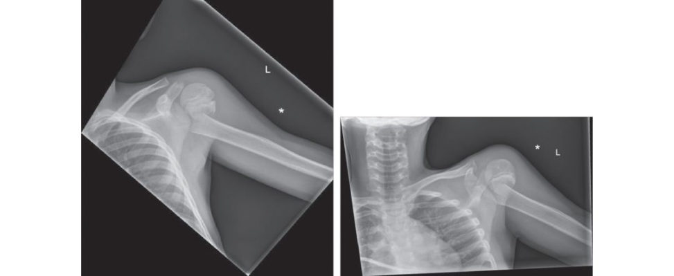 Figure 16.1