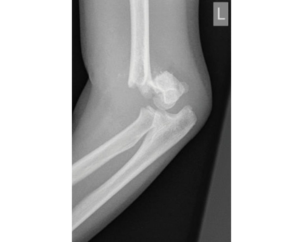 Figure 16.4a
