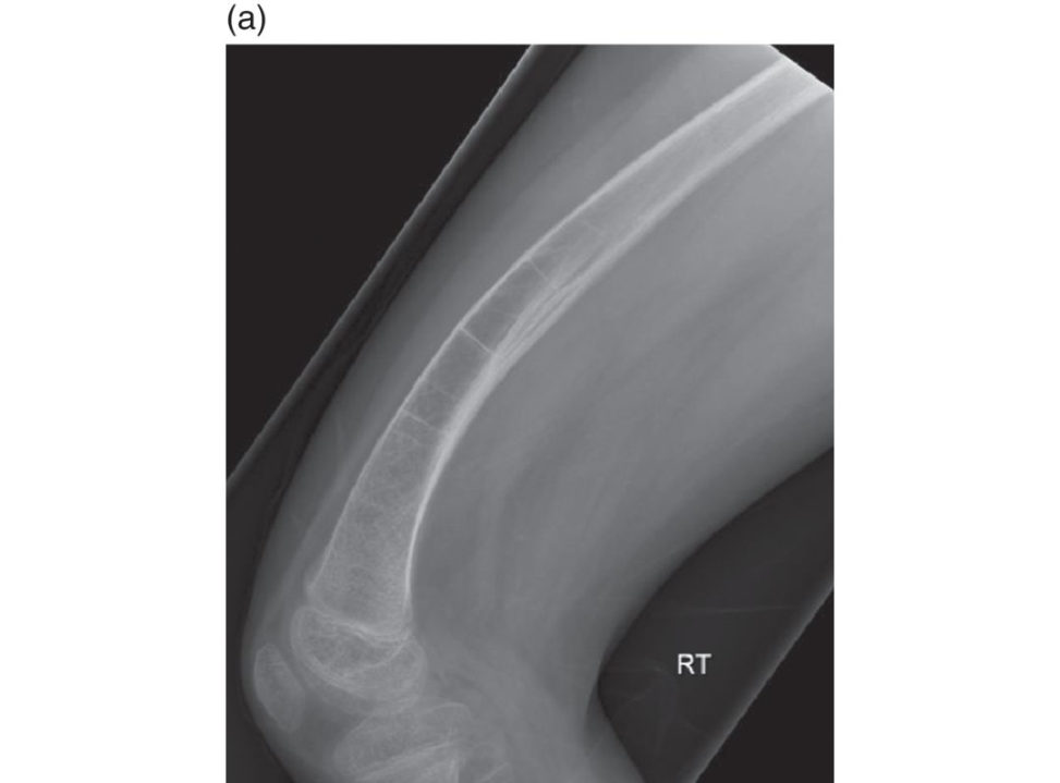 Figure 16.6a