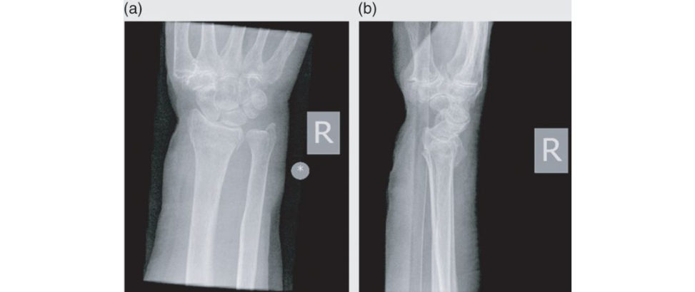 Figure 17.1a