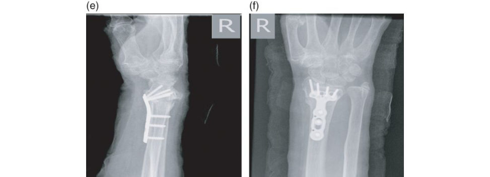 Figure 17.1e