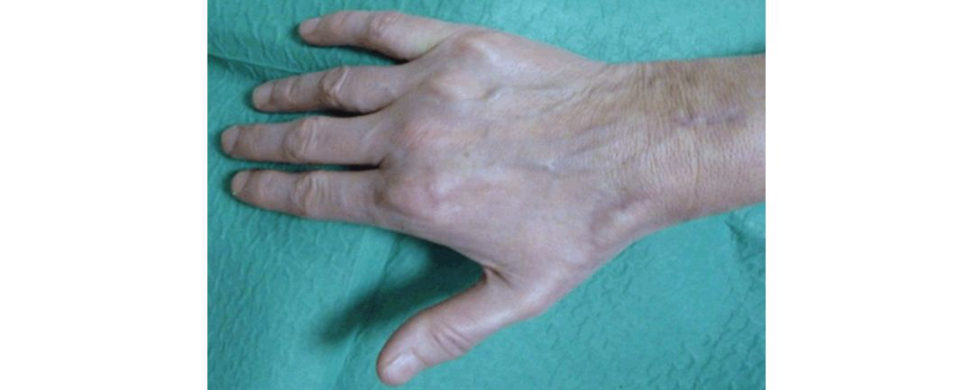 Figure 17.2b