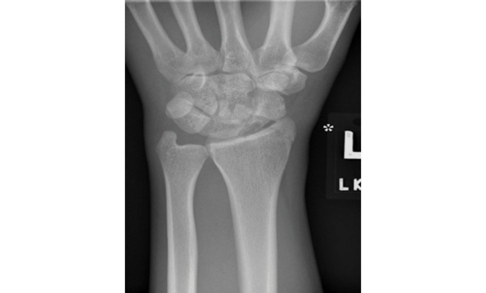 Figure 17.3a