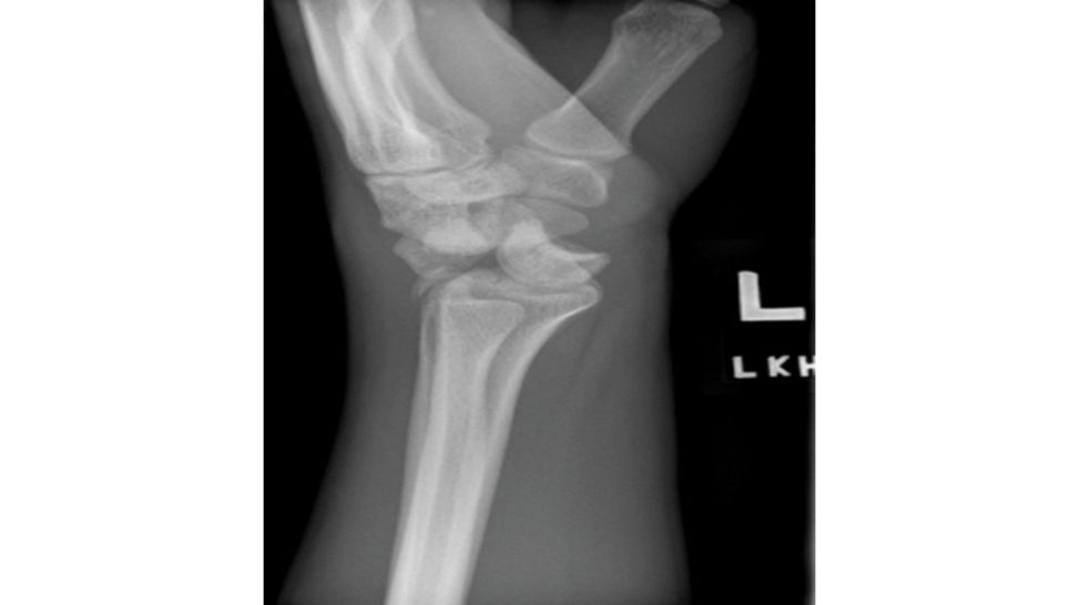 Figure 17.3b