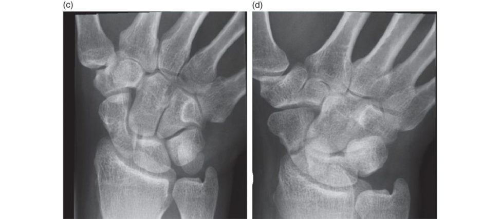 Figure 17.4c