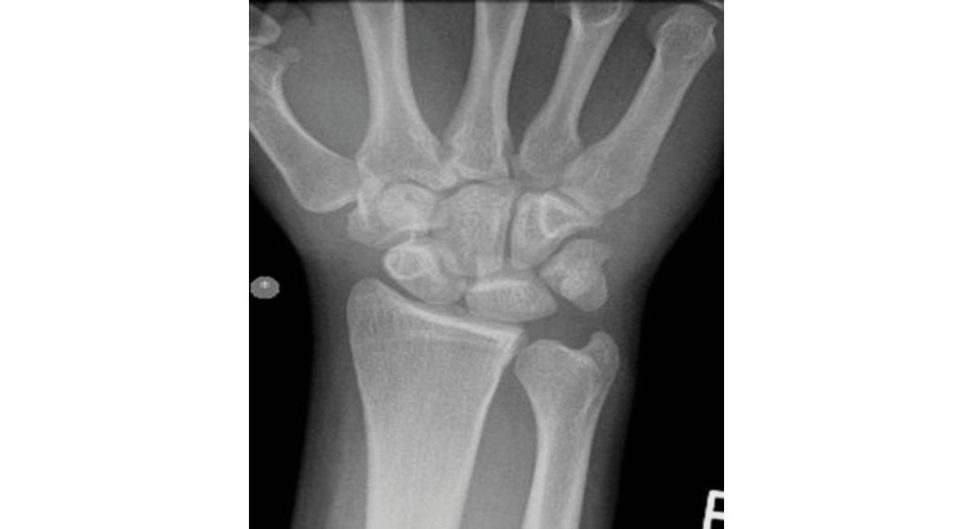 Figure 17.5a