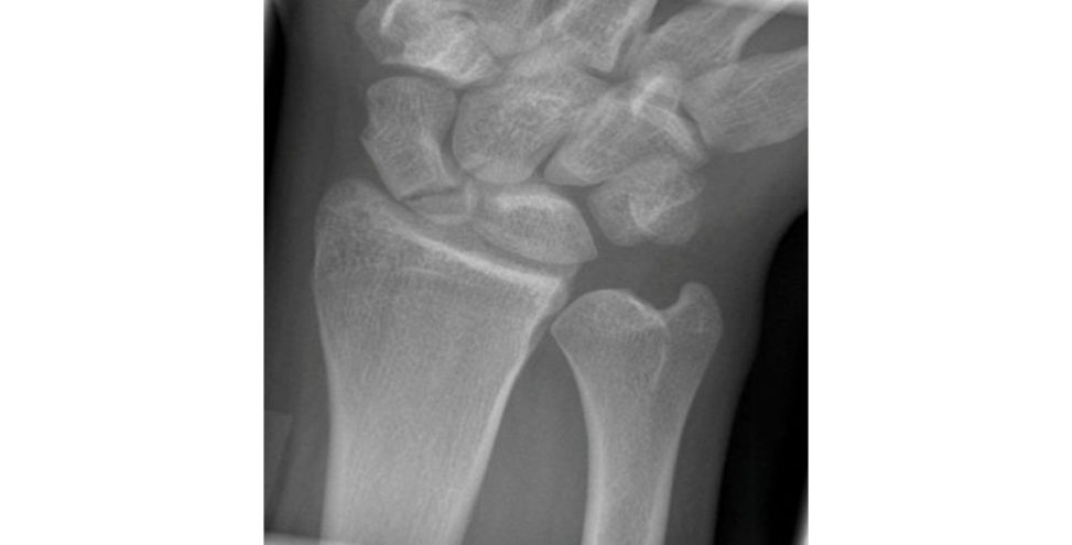 Figure 17.5b