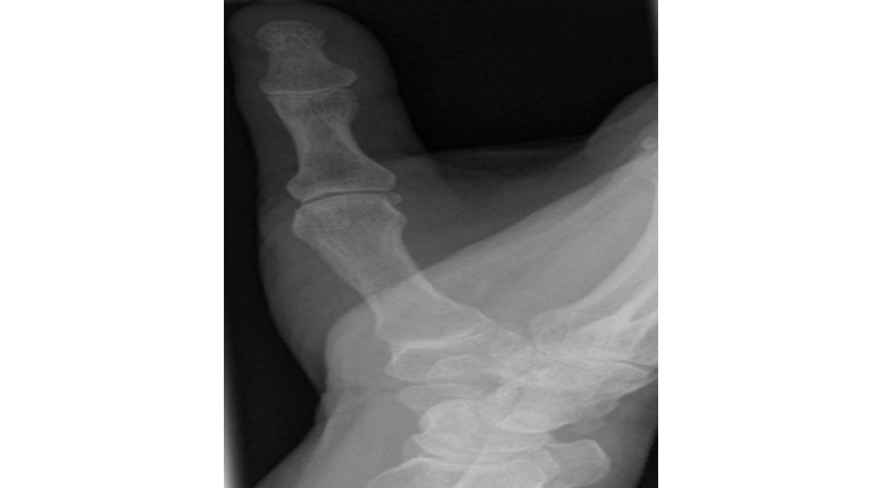 Figure 17.7b