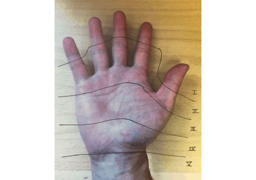 Figure 17.9