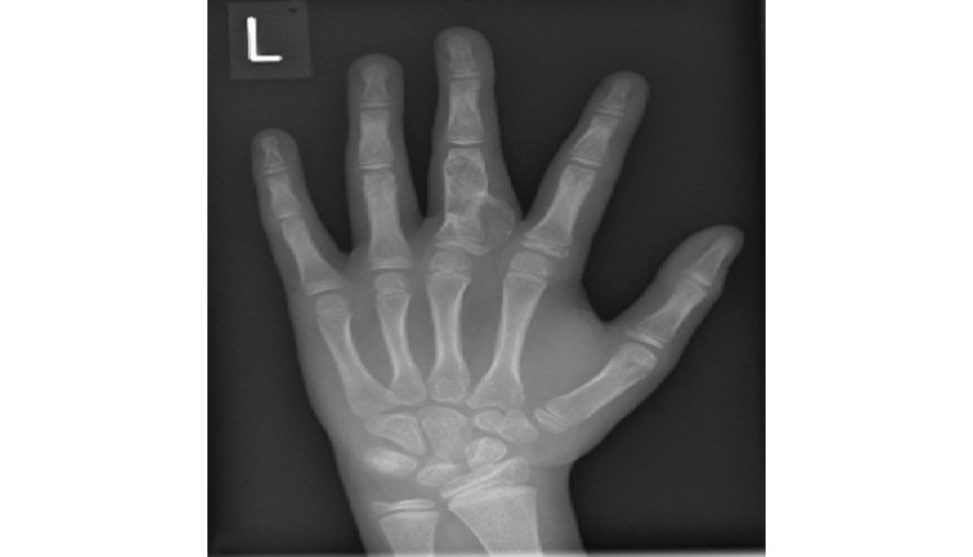 Figure 17.10b