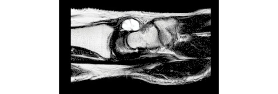 Figure 17.11b