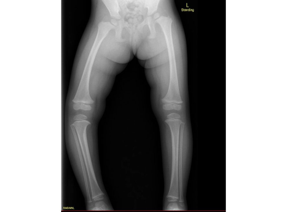 Figure 18.30