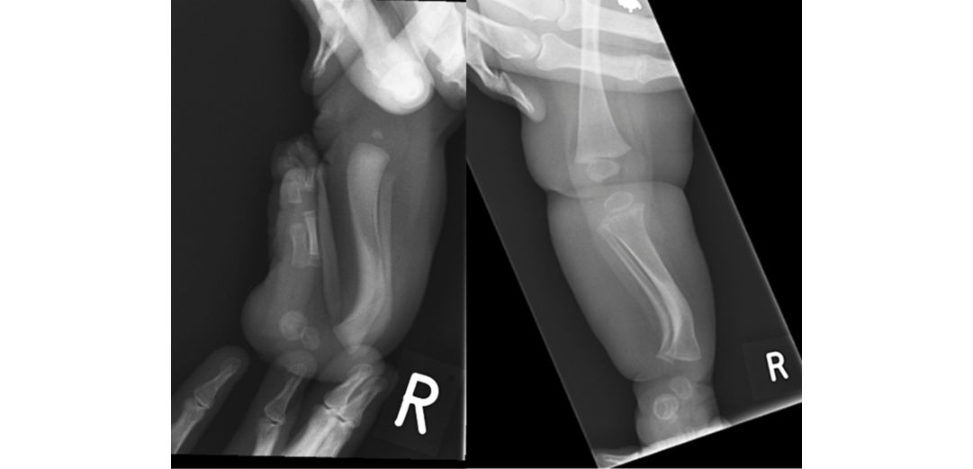 Figure 18.37