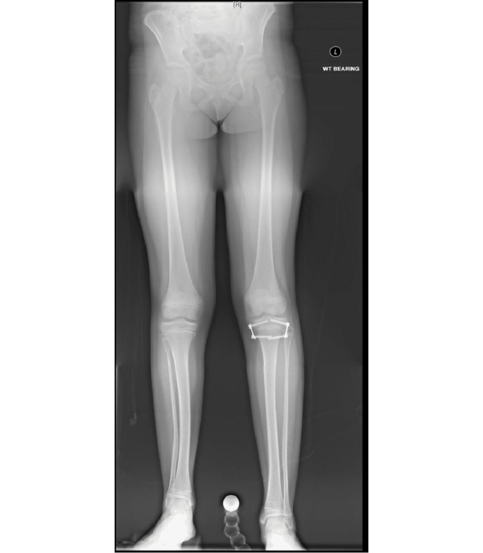 Figure 18.44