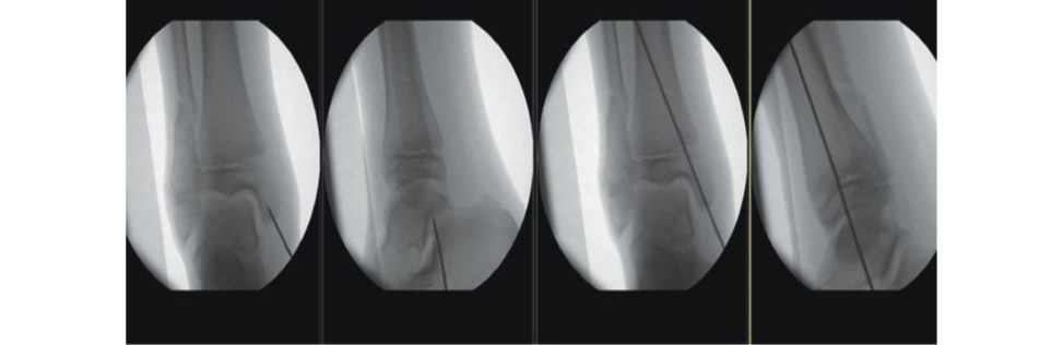 Figure 18.47