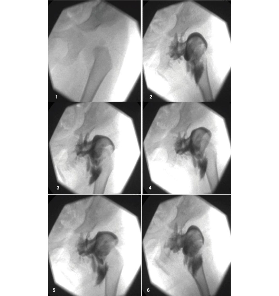 Figure 18.56