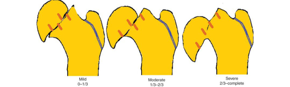 Figure 18.3