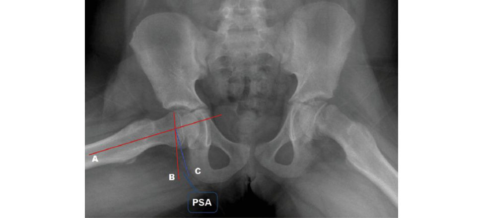 Figure 18.7