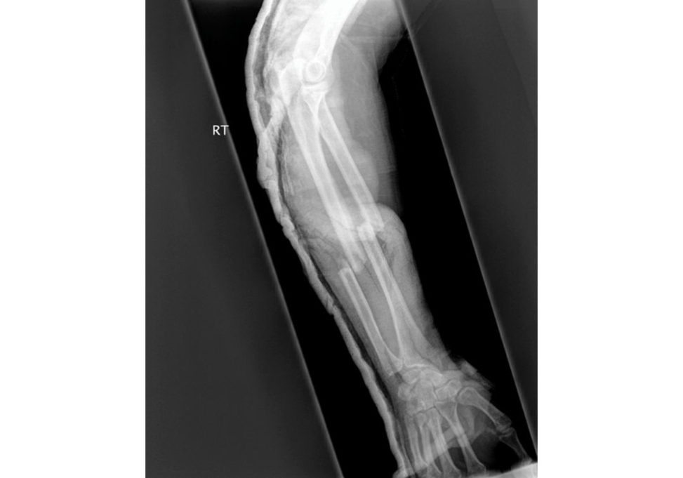 Figure 19.3
